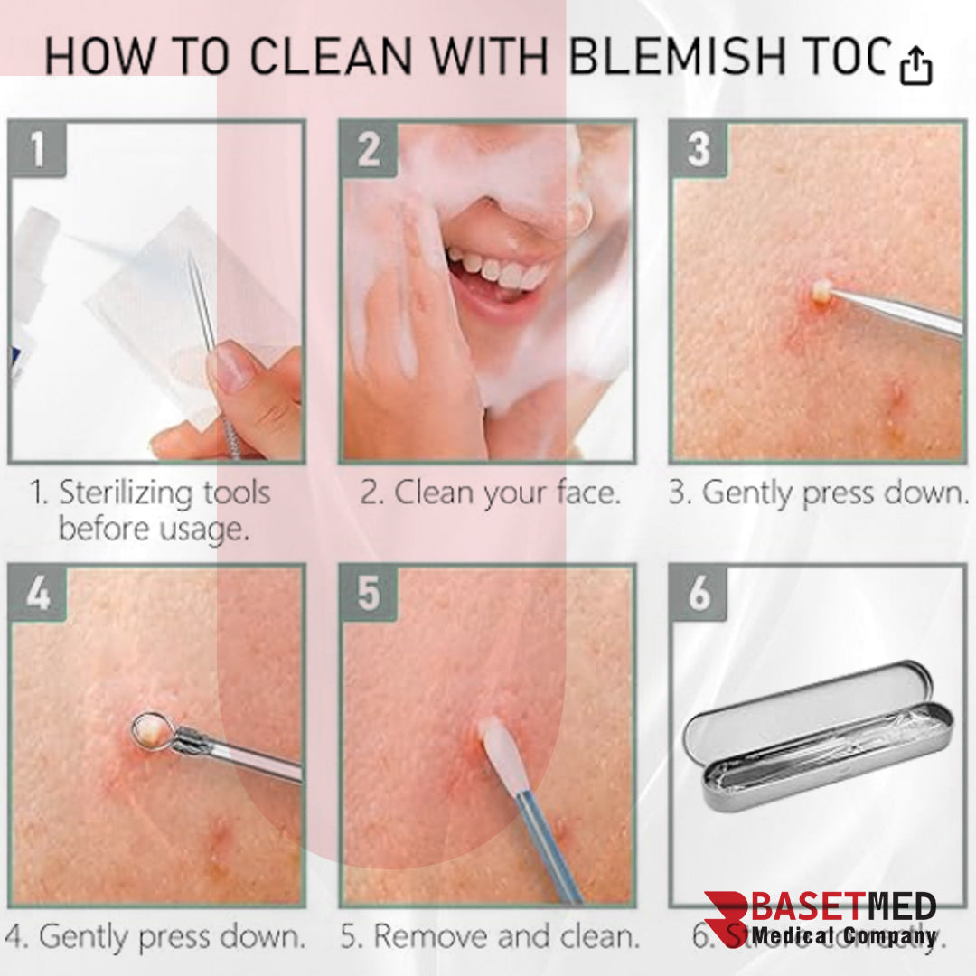 Stainless Steel Blackhead & Acne Extractor Kit | | 1050