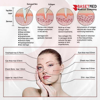 Dr. Pen M5 Wireless Microneedling Pen ||1155