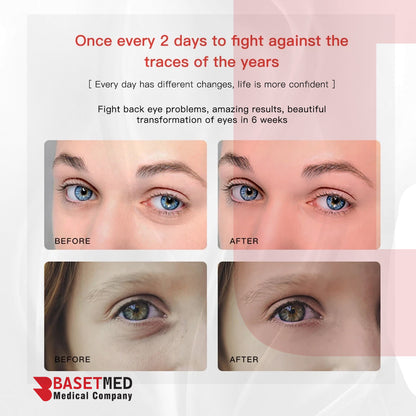 BB Eyes Beauty Care Machine || code 1073
