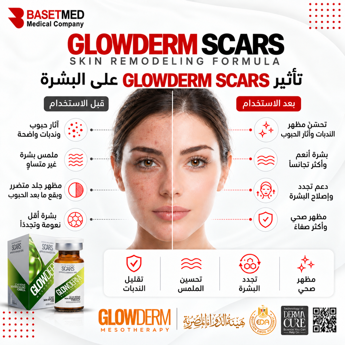 Glowderm Mesotherapy scars||1288