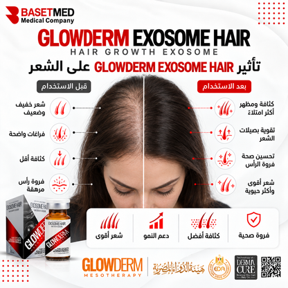 Glowderm Mesotherapy Exosome Hair ||1294