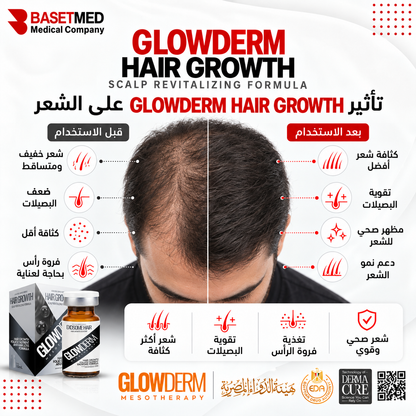 Glowderm Mesotherapy Hair Growth ||1295