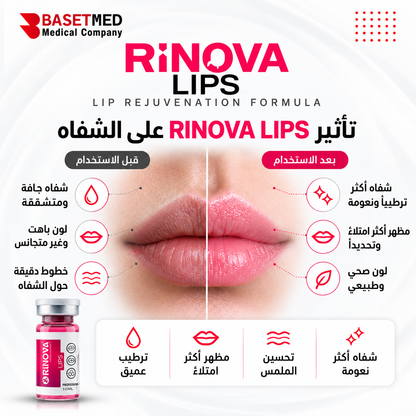 Rinova Lips ||1301