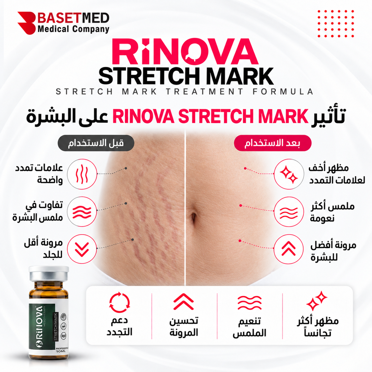 Rinova Stretch Mark ||1321