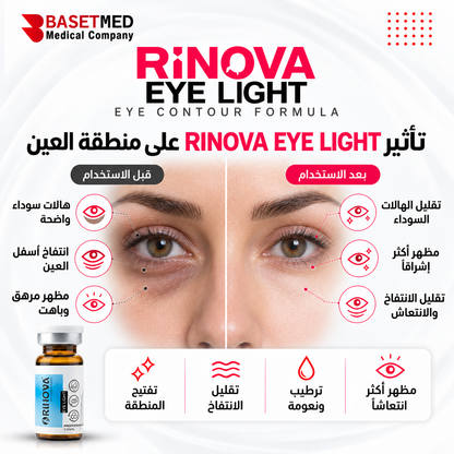 Rinova Eye Light ||1309