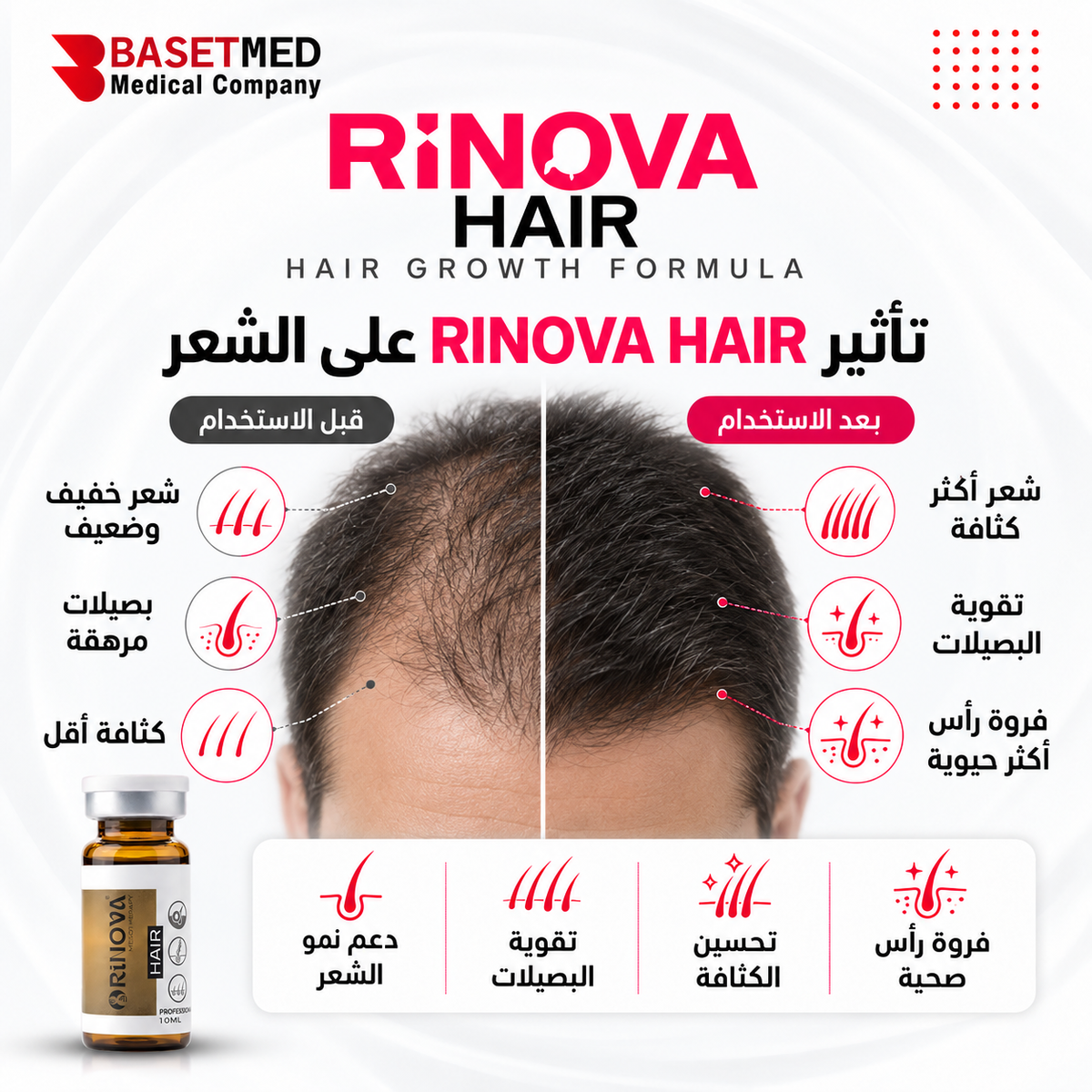 Rinova Hair ||1311