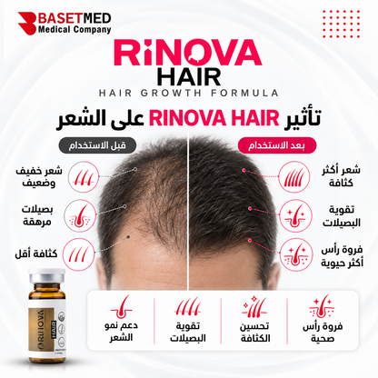 Rinova Hair ||1311