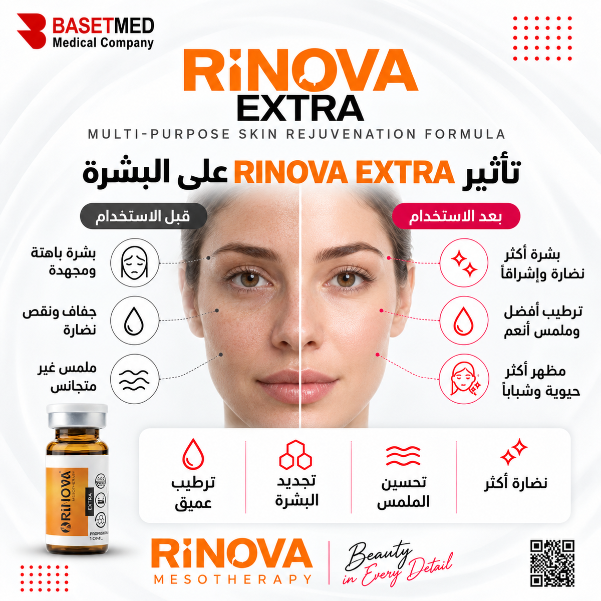 Rinova Extra ||1312
