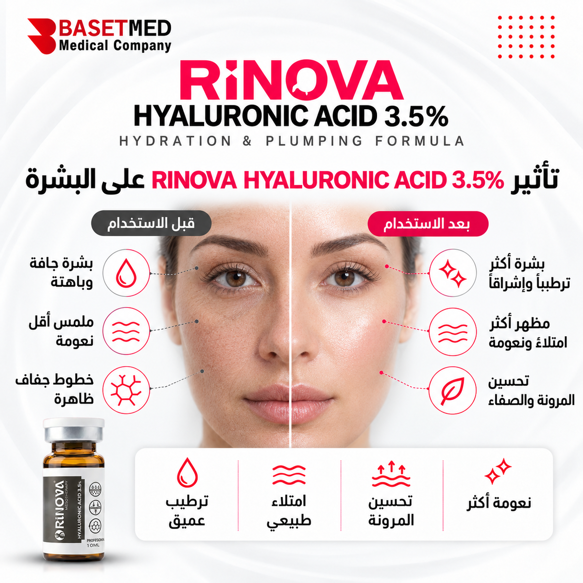 Rinova Hyaluronic Acid 3.5% ||1303