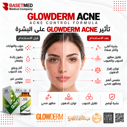 Glowderm Mesotherapy Acne .||1290