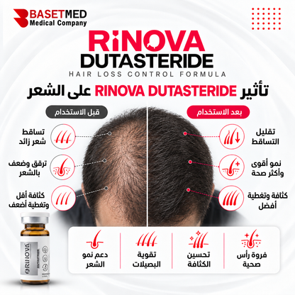 Rinova Dutastride ||1314