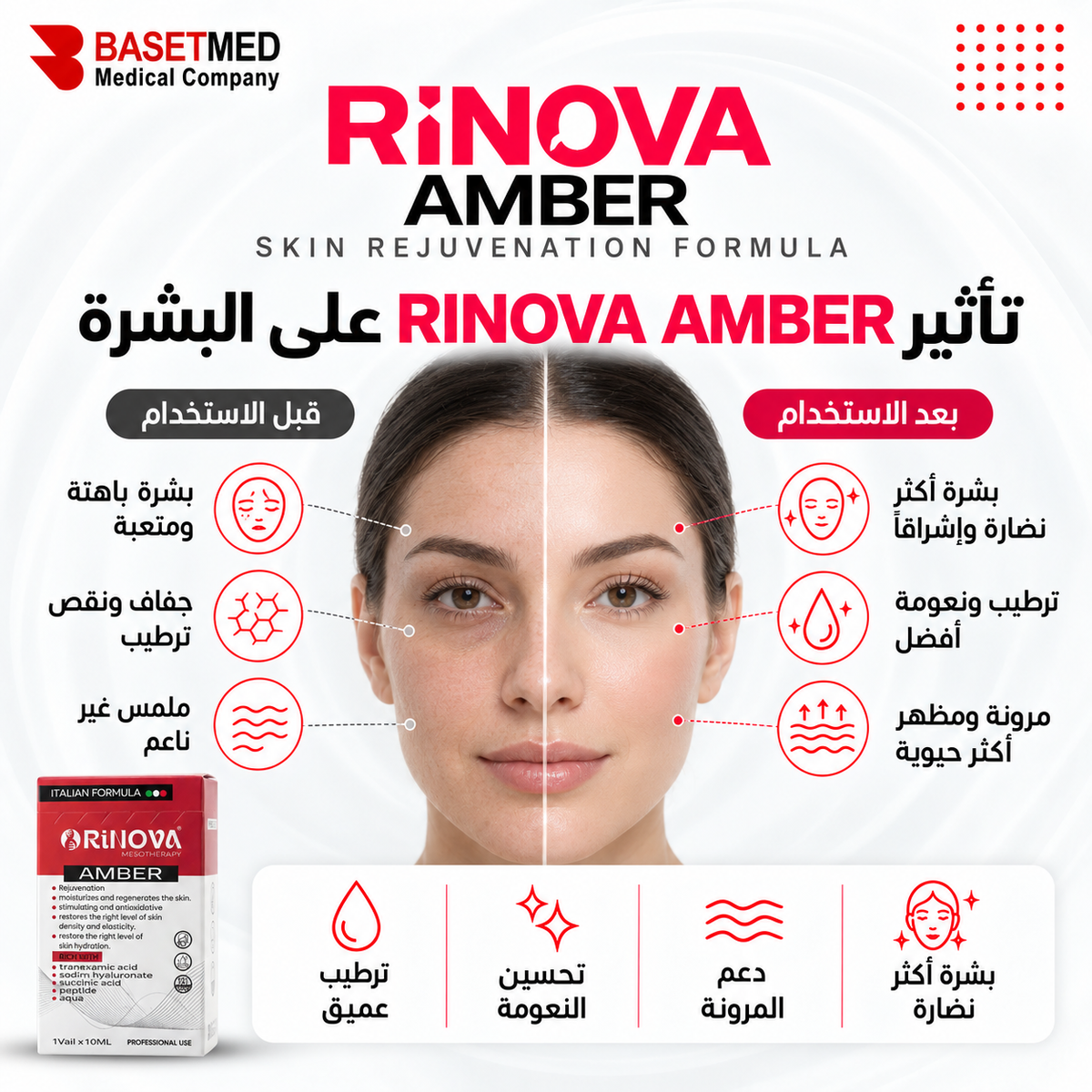 Rinova Amber ||1316