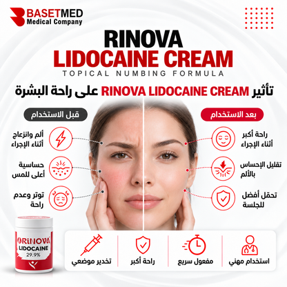 Rinova Lidocaine Cream ||1318