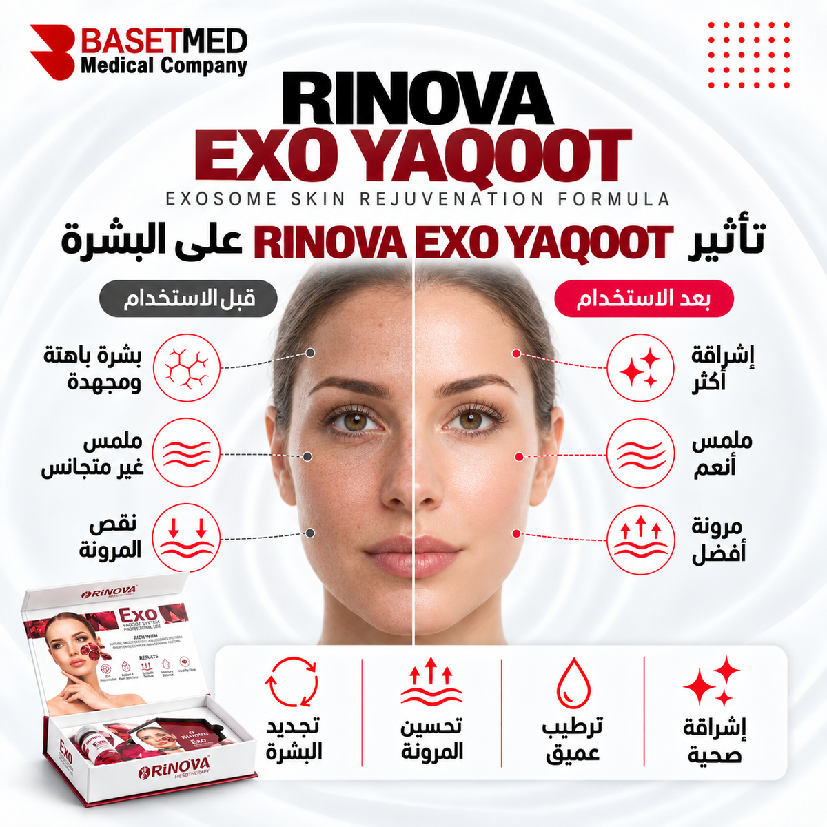 Rinova Exo Yaqoot ||1315