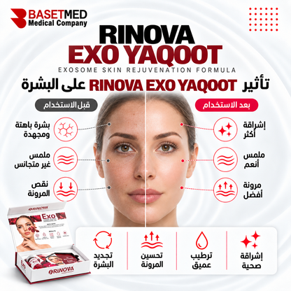 Rinova Exo Yaqoot ||1315
