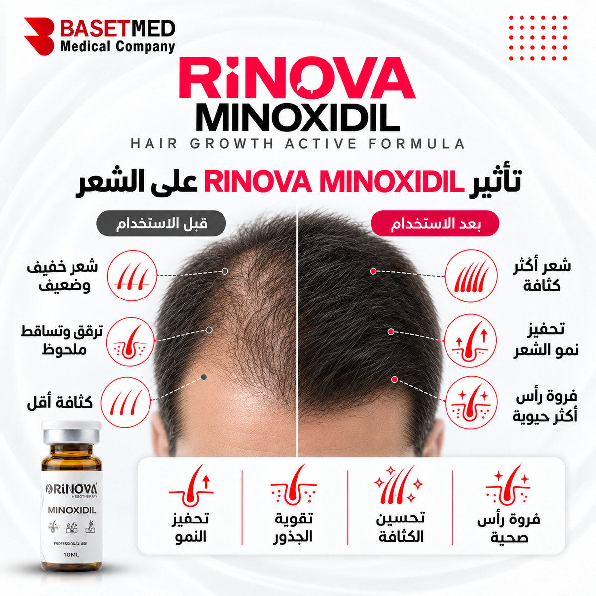 Rinova Minoxidil ||1313