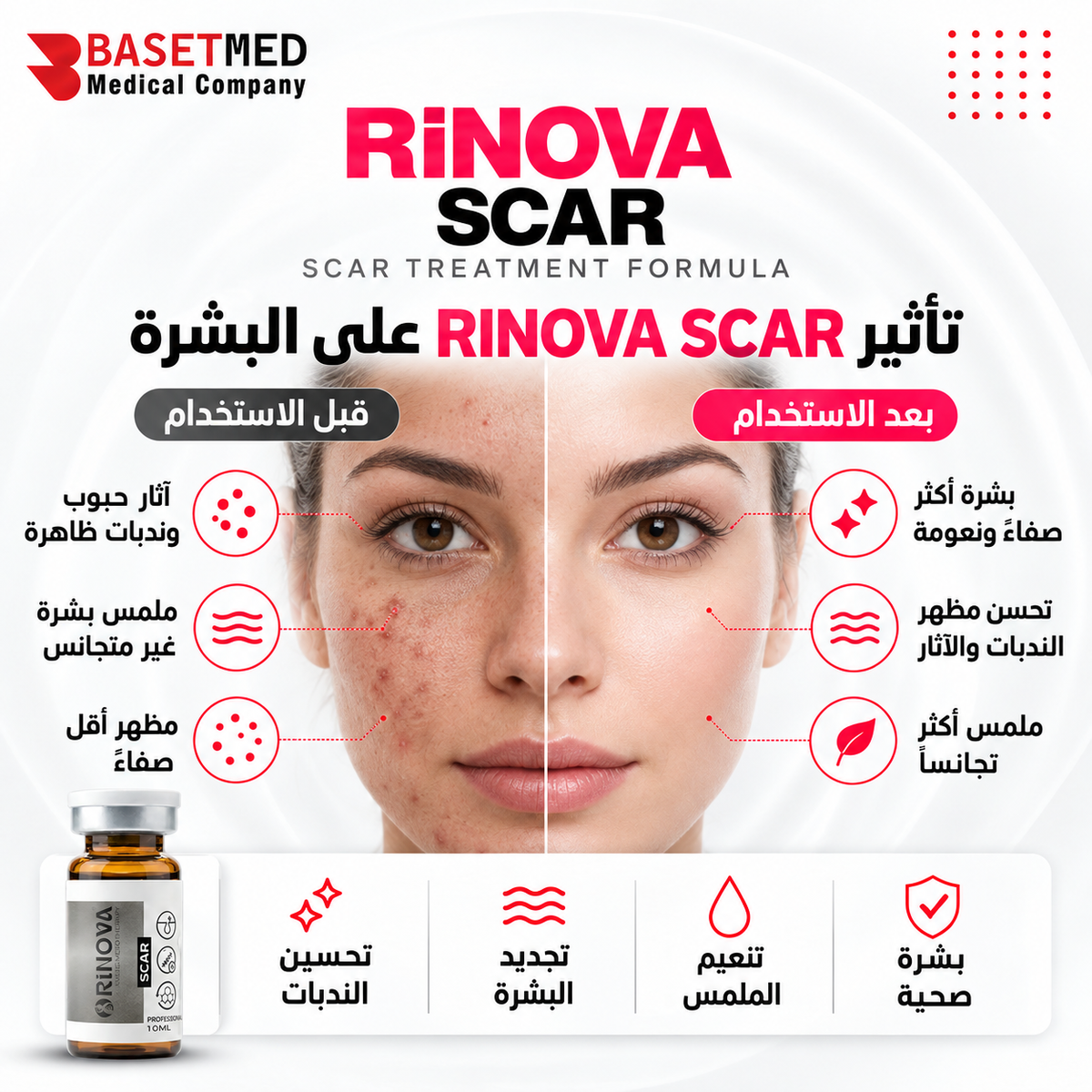 Rinova Scar ||1306