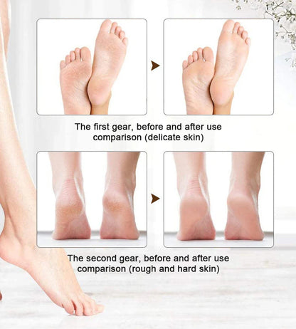 Rechargeable Foot Dead Skin Remover || code 1014