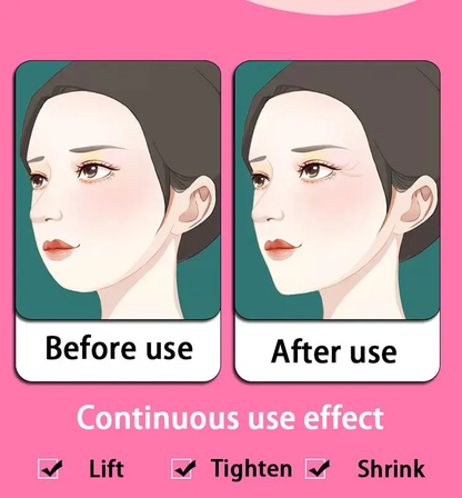 حزام شد الذقن والخدود – لتحديد الوجه على شكل V