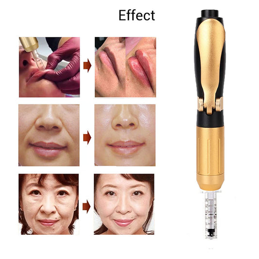 Dual-Head Cosmetic Pen – Needle-Free Lip Filler | Code 1087