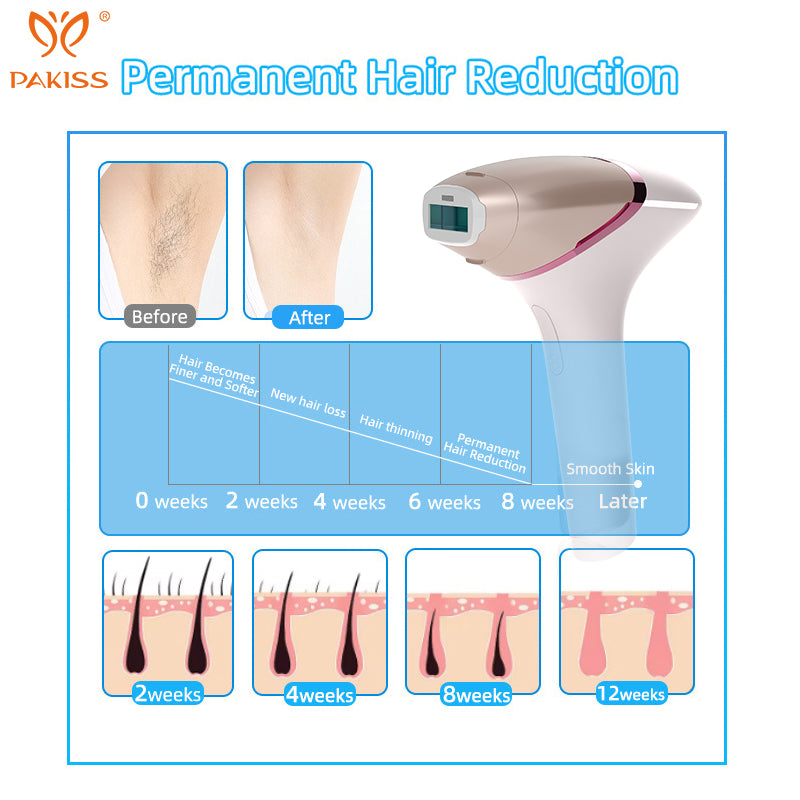 PAKISS Battery-Operated IPL Hair Removal Device  | CODE 1097