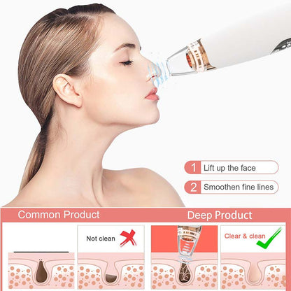 Facial Pore Vacuum Blackhead Remover || code 1015