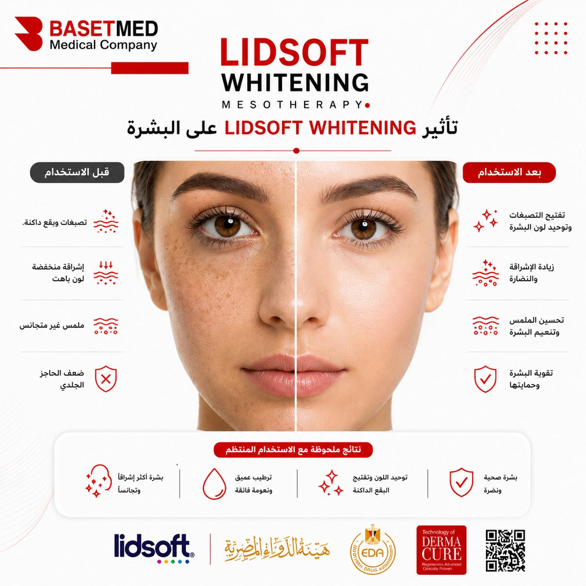 Lidsoft Whitening Mesotherapy ||1123